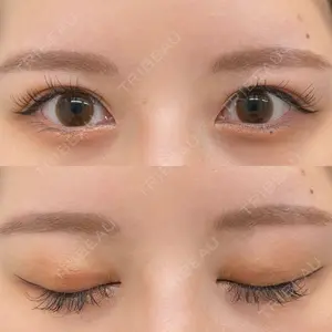 いちのせ形成外科・皮膚科 眼瞼＆フェイスクリニック口コミ
