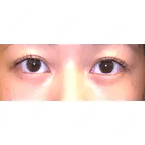 APOLLO BEAUTY CLINIC口コミ