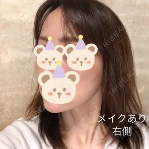 X CLINIC X CLINIC 銀座院口コミ
