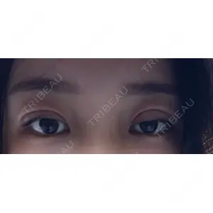 東京BELLEZZAクリニック口コミ