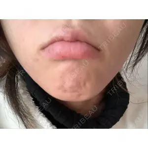 TCB東京中央美容外科 TCB東京中央美容外科 新宿東口院口コミ