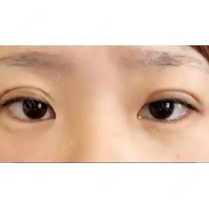 口コミ