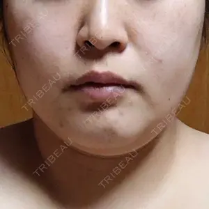 湘南美容クリニック 湘南美容クリニック 金山院口コミ