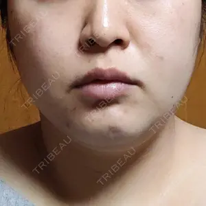 湘南美容クリニック 湘南美容クリニック 金山院口コミ
