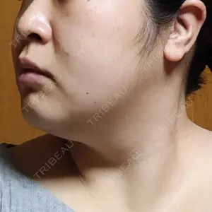 湘南美容クリニック 湘南美容クリニック 金山院口コミ