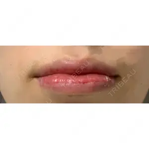 B-LINE CLINIC B-LINE CLINIC 池袋院口コミ