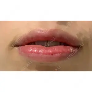 B-LINE CLINIC B-LINE CLINIC 池袋院口コミ