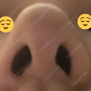 リッツ美容外科 大阪院口コミ