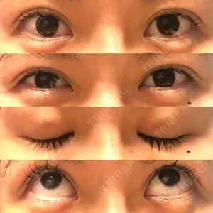 口コミ