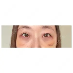 APOLLO BEAUTY CLINIC口コミ