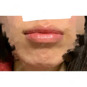 B-LINE CLINIC B-LINE CLINIC 池袋院口コミ