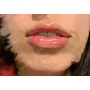 B-LINE CLINIC B-LINE CLINIC 池袋院口コミ