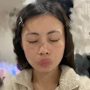 池袋麗歯科・美容皮膚科口コミ