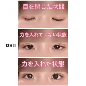 牧野美容クリニック口コミ