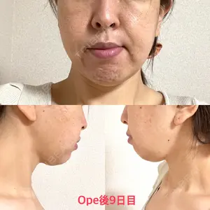 X CLINIC X CLINIC 銀座院口コミ