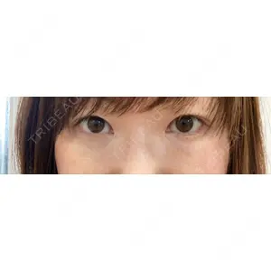 X CLINIC X CLINIC 銀座院口コミ