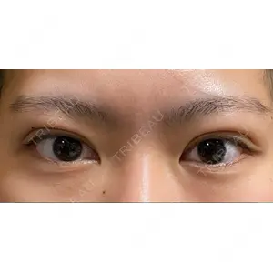 湘南美容クリニック 湘南美容クリニック 池袋東口院口コミ