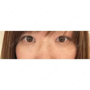 X CLINIC X CLINIC 銀座院口コミ