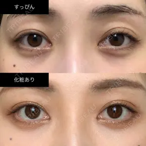 APOLLO BEAUTY CLINIC口コミ
