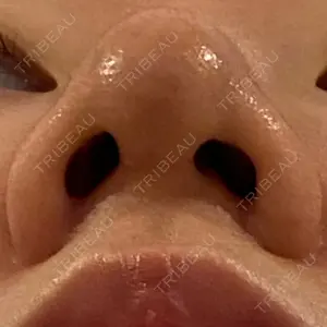 湘南美容クリニック 湘南美容クリニック 池袋西口院口コミ