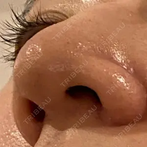 湘南美容クリニック 湘南美容クリニック 池袋西口院口コミ