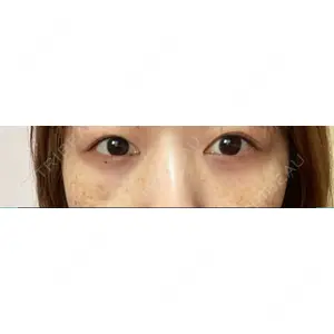 APOLLO BEAUTY CLINIC口コミ