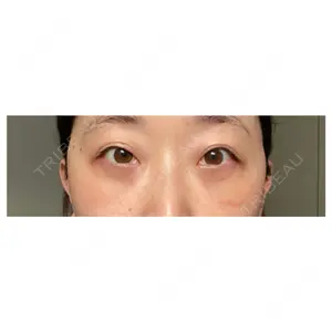 APOLLO BEAUTY CLINIC口コミ
