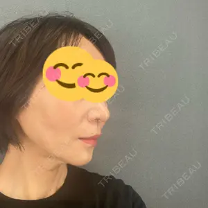X CLINIC X CLINIC 銀座院口コミ