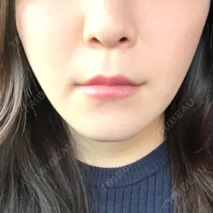X CLINIC X CLINIC 銀座院口コミ