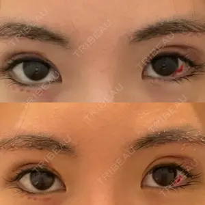 B-LINE CLINIC B-LINE CLINIC 池袋院口コミ