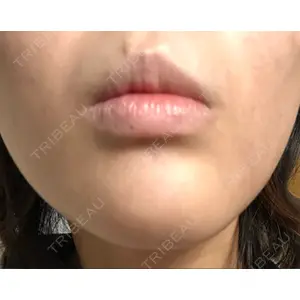 TCB東京中央美容外科 TCB東京中央美容外科 新宿東口院口コミ