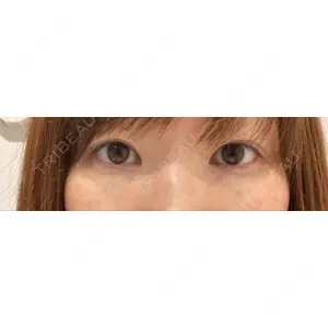 X CLINIC X CLINIC 銀座院口コミ
