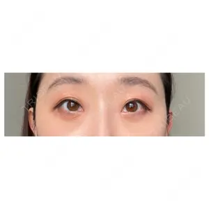 APOLLO BEAUTY CLINIC口コミ