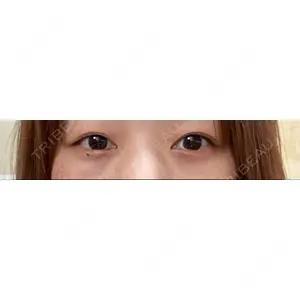 APOLLO BEAUTY CLINIC口コミ