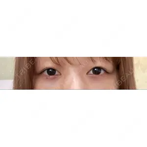 APOLLO BEAUTY CLINIC口コミ