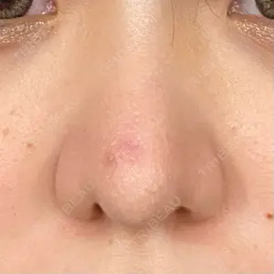 リッツ美容外科 大阪院口コミ