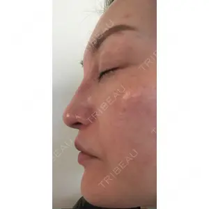 Rinato Beauty Clinic口コミ