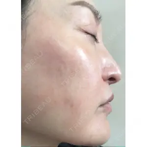 Rinato Beauty Clinic口コミ