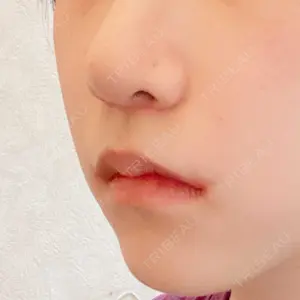 くさのたろうクリニック口コミ
