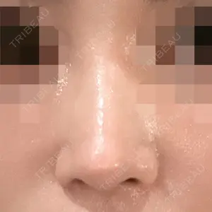 口コミ