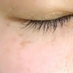 南青山TOKUNAKAクリニック口コミ