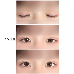 牧野美容クリニック口コミ