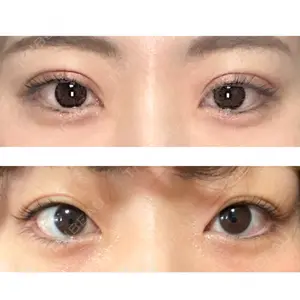 湘南美容クリニック 湘南美容クリニック 池袋東口院口コミ