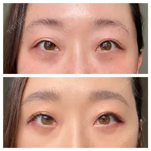 APOLLO BEAUTY CLINIC口コミ