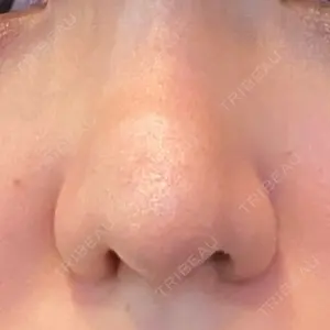 リッツ美容外科 大阪院口コミ