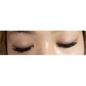 id美容外科の口コミ