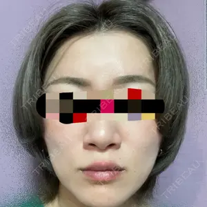 TCB東京中央美容外科 TCB東京中央美容外科 中野院口コミ