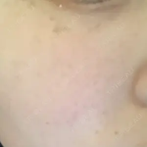 南青山TOKUNAKAクリニック口コミ