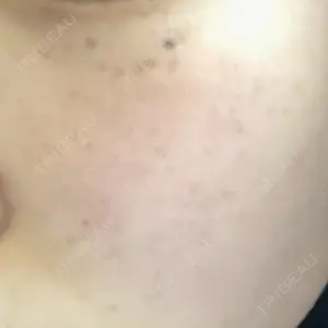 南青山TOKUNAKAクリニック口コミ