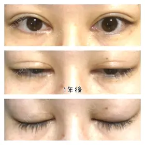 いちのせ形成外科・皮膚科 眼瞼＆フェイスクリニック口コミ